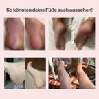 Betaya SmoothFeet - Premium Hornhautenferner-Set