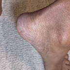 Betaya SmoothFeet - Premium Hornhautenferner-Set